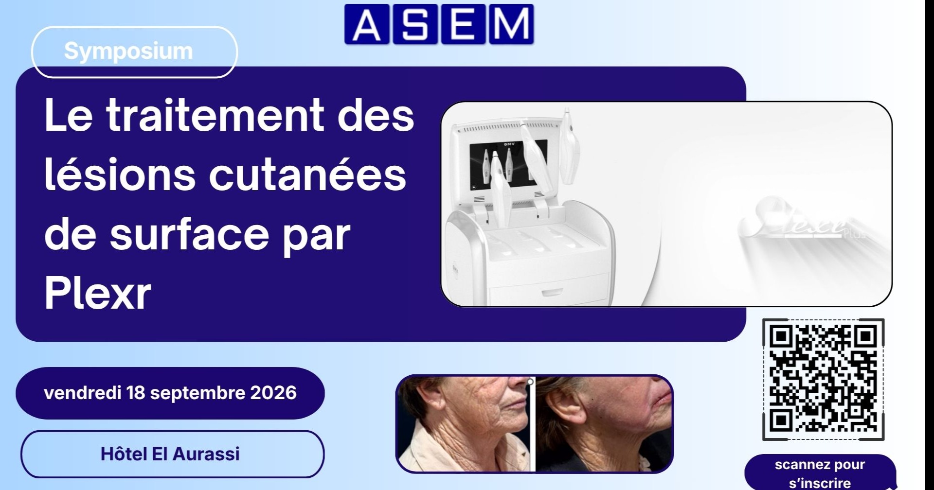 Symposium: ​Le traitement des lésions cutanées de surface par Plexr, ASEM - 18 septembre 2026, Hôtel  El-Aurasi cover image